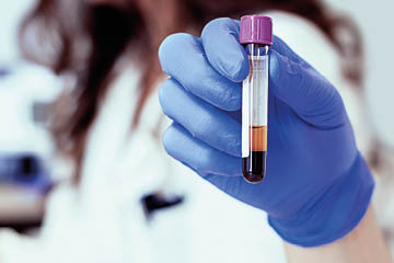 Darbinieka roka ar laboratorijas mēģeni
